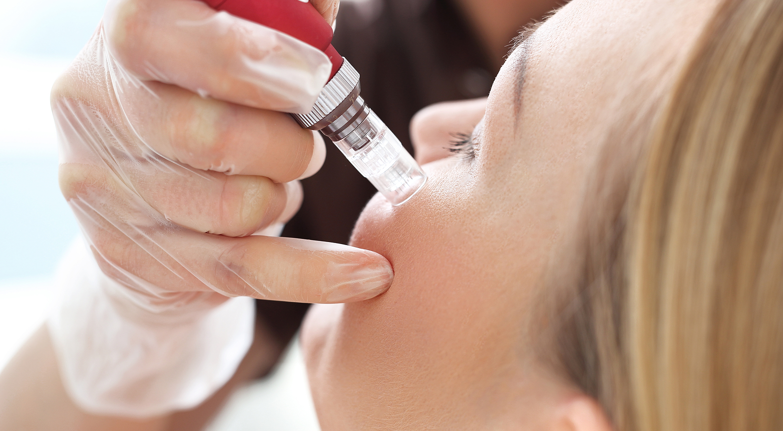 Microneedling med spa treatment at Luxura